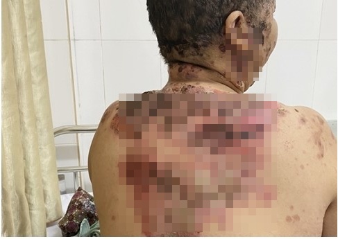 Chua benh ve da anh 1