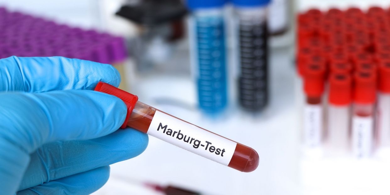 Nguoi nhiem virus Marburg anh 1