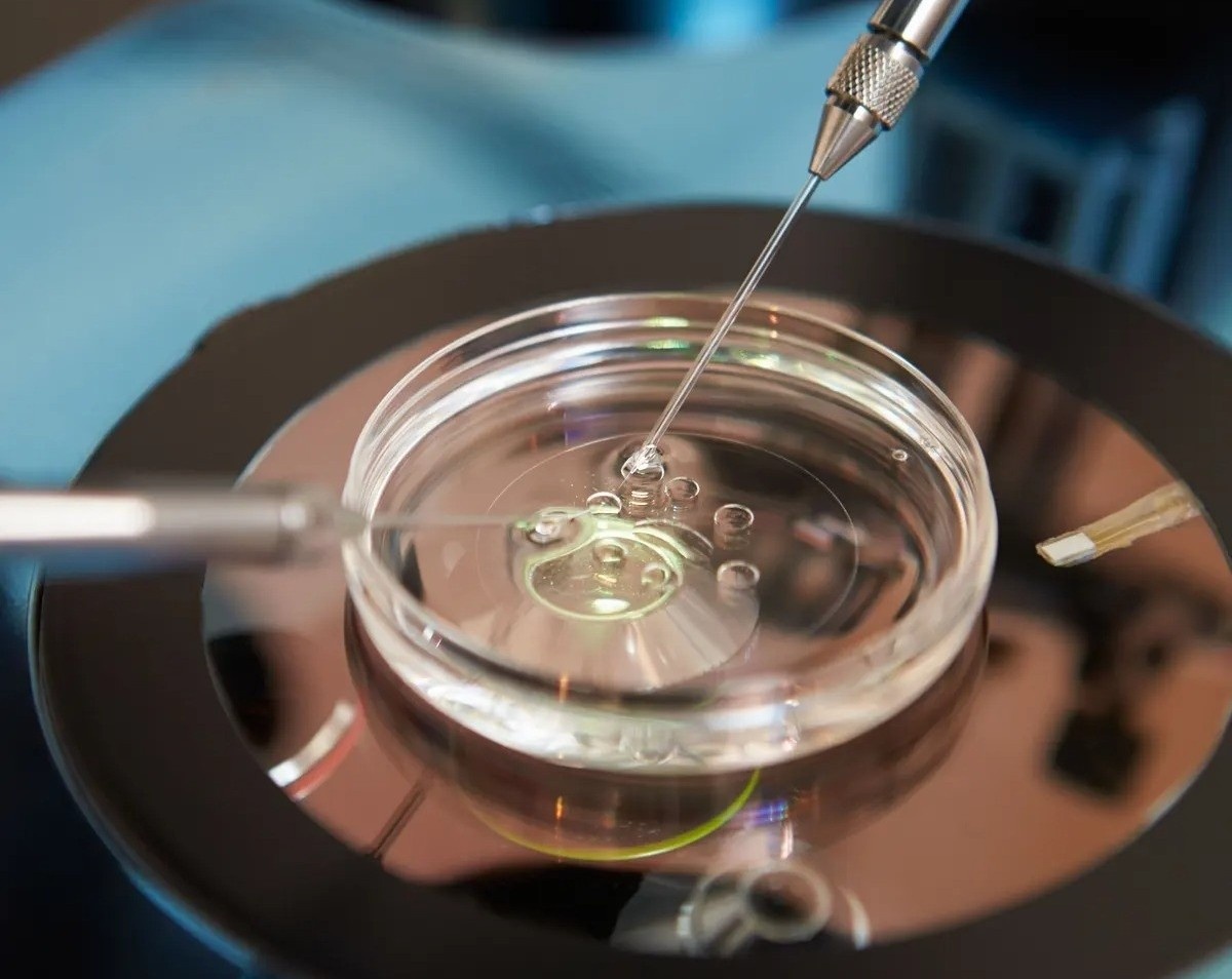 Vo sinh do pha thai anh 1