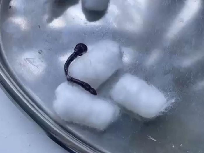 Phat hien dia trong mui anh 1