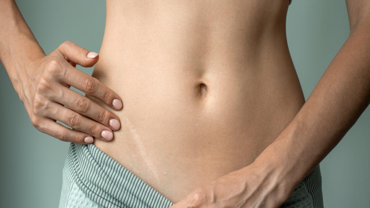 Su that ve ruot thua anh 1