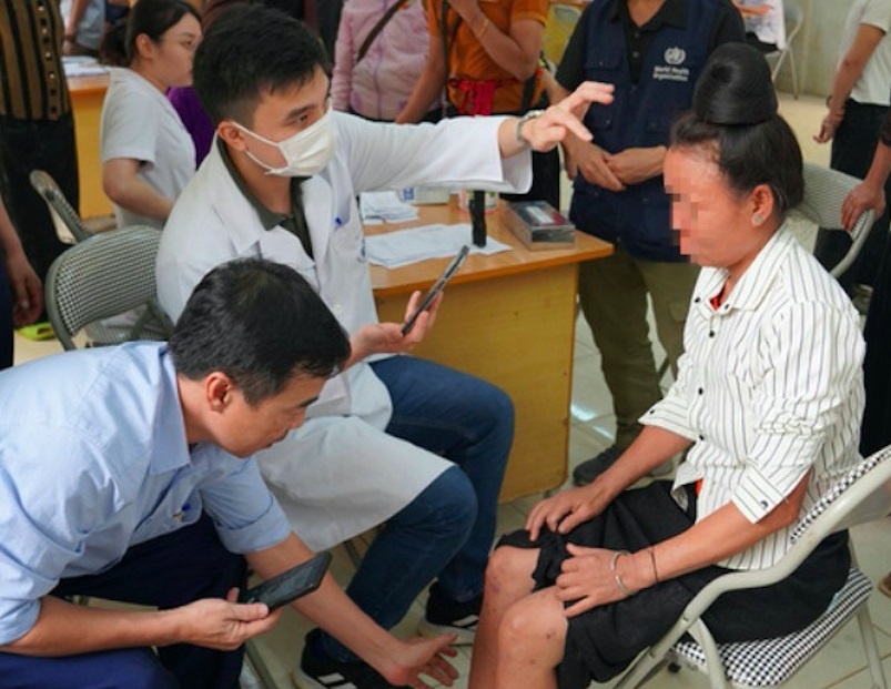 Mac benh phong anh 1