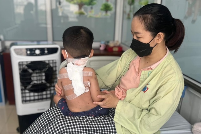 Tuong la bot thong thuong, tre bat ngo duoc phat hien benh hiem hinh anh