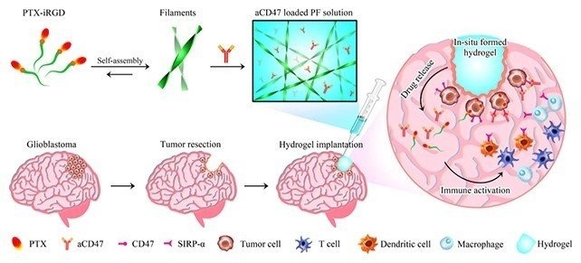 Benh ung thu nao anh 2
