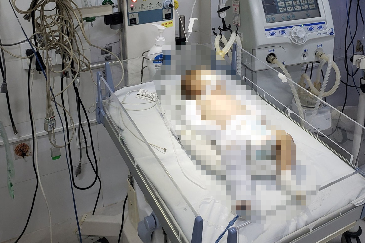 Be 2 thang tuoi chan thuong so nao, gay chan tay nghi bi bao hanh hinh anh