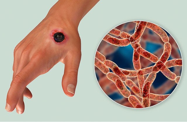 o dich benh than anh 1