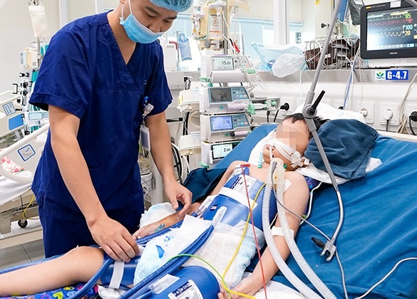 Nhieu tre duoi nuoc mua he, bac si huong dan 5 buoc cap cuu ban dau hinh anh