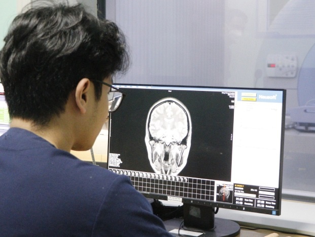 Tu con dau dau, nam benh nhan 32 tuoi bi dot quy nang hinh anh