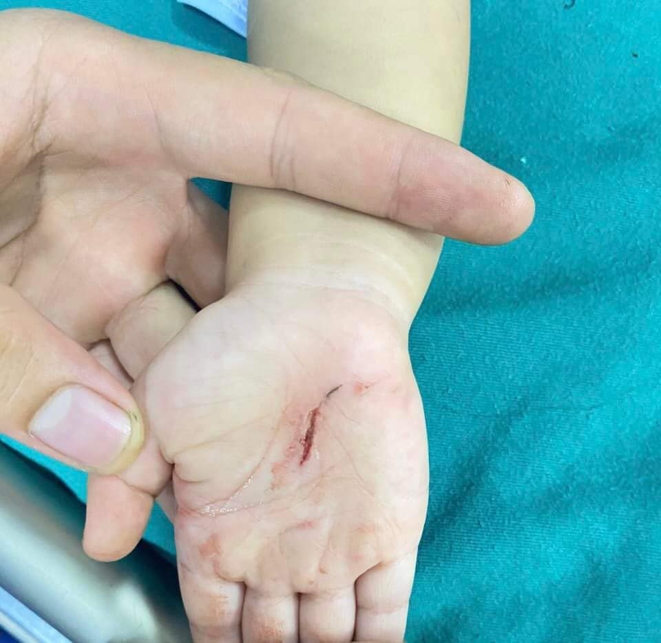 be trai bi cho can anh 1