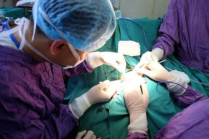 Tu ruoc hoa sau hut mo bung hinh anh