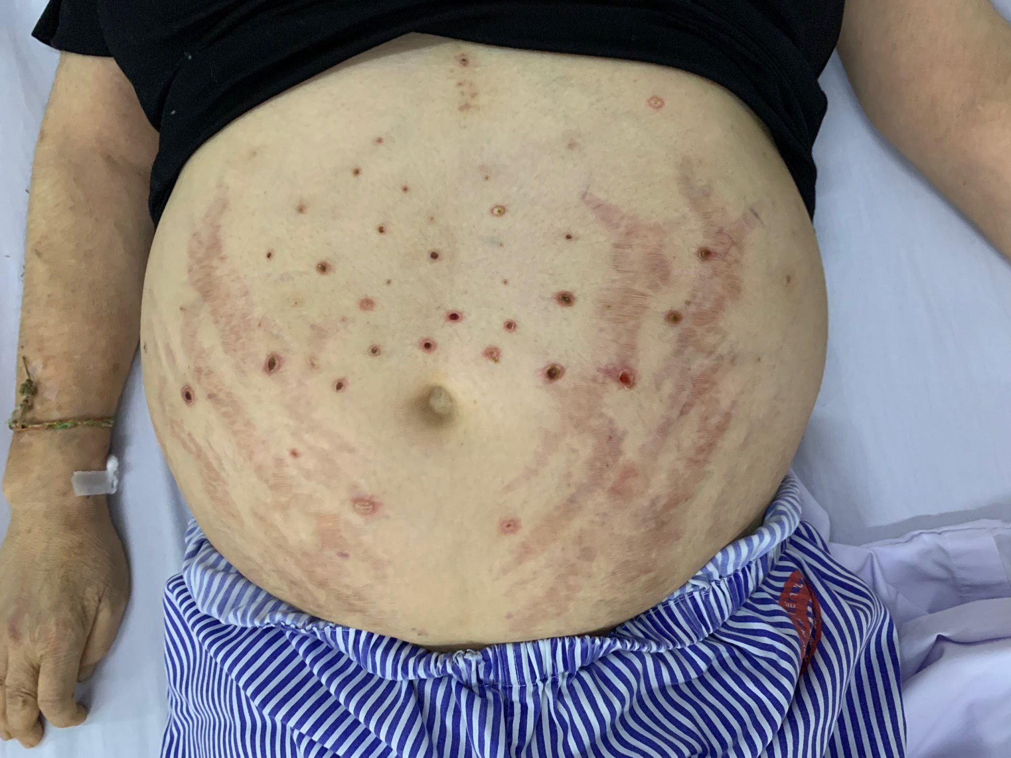 ong đốt khắp người  ảnh 1 ong dot khap nguoi anh 1