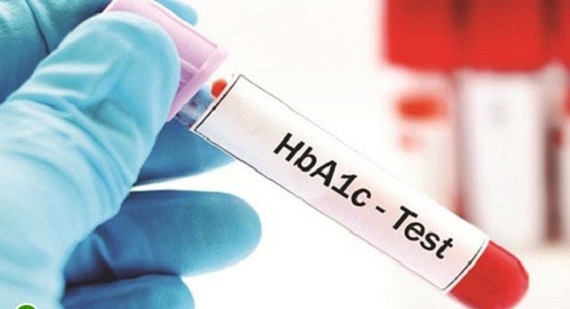 benh dai thao duong anh 1