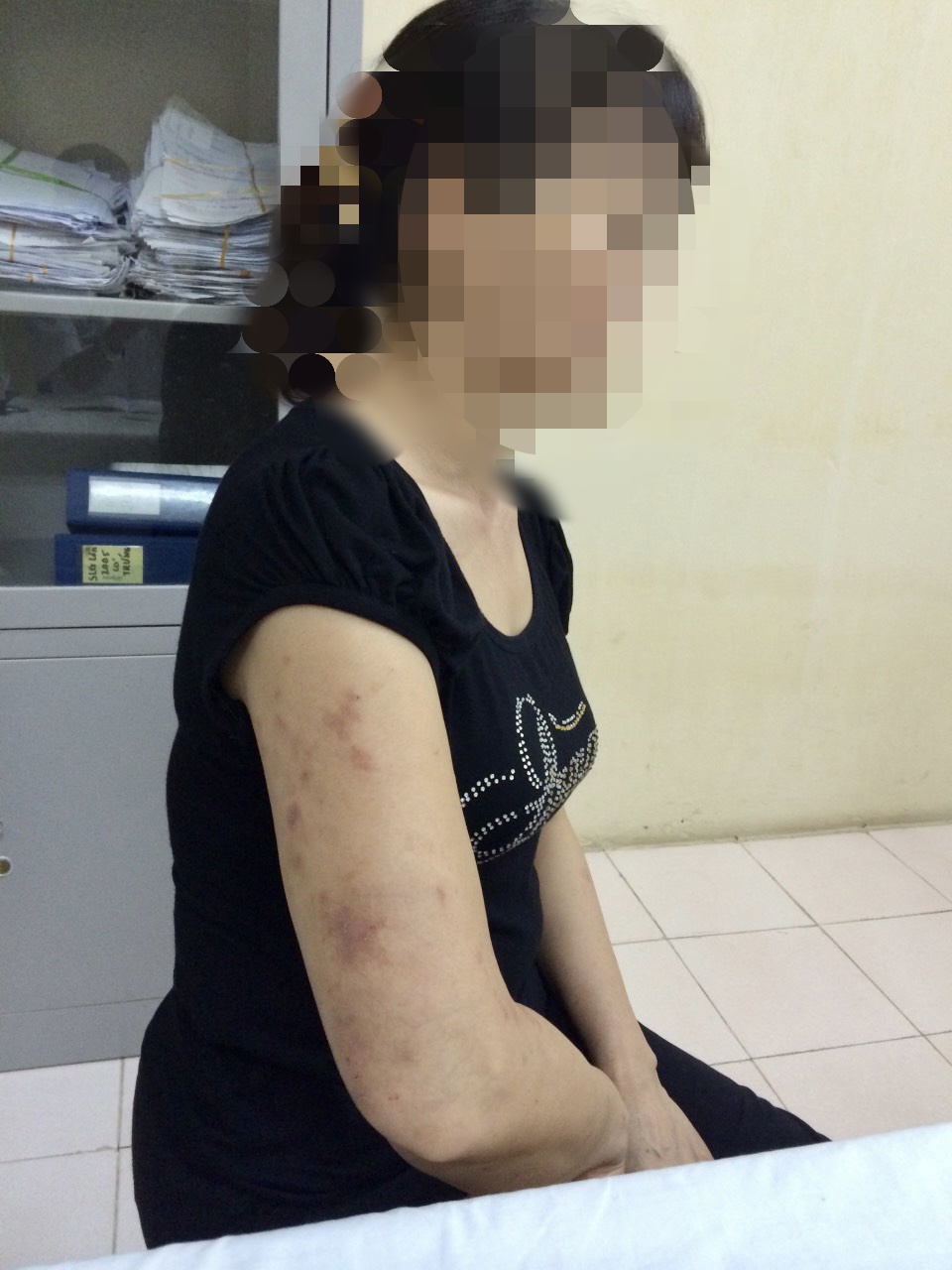 giun dua tu cho anh 1