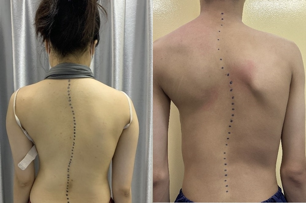 Cong veo cot song anh 1