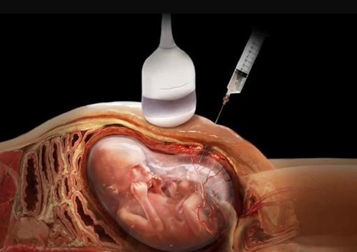 phu nu mang thai anh 1