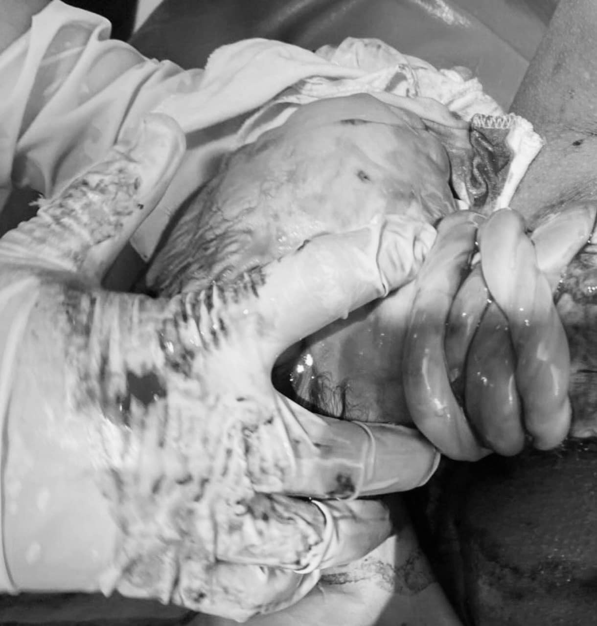 day ron quan co anh 1