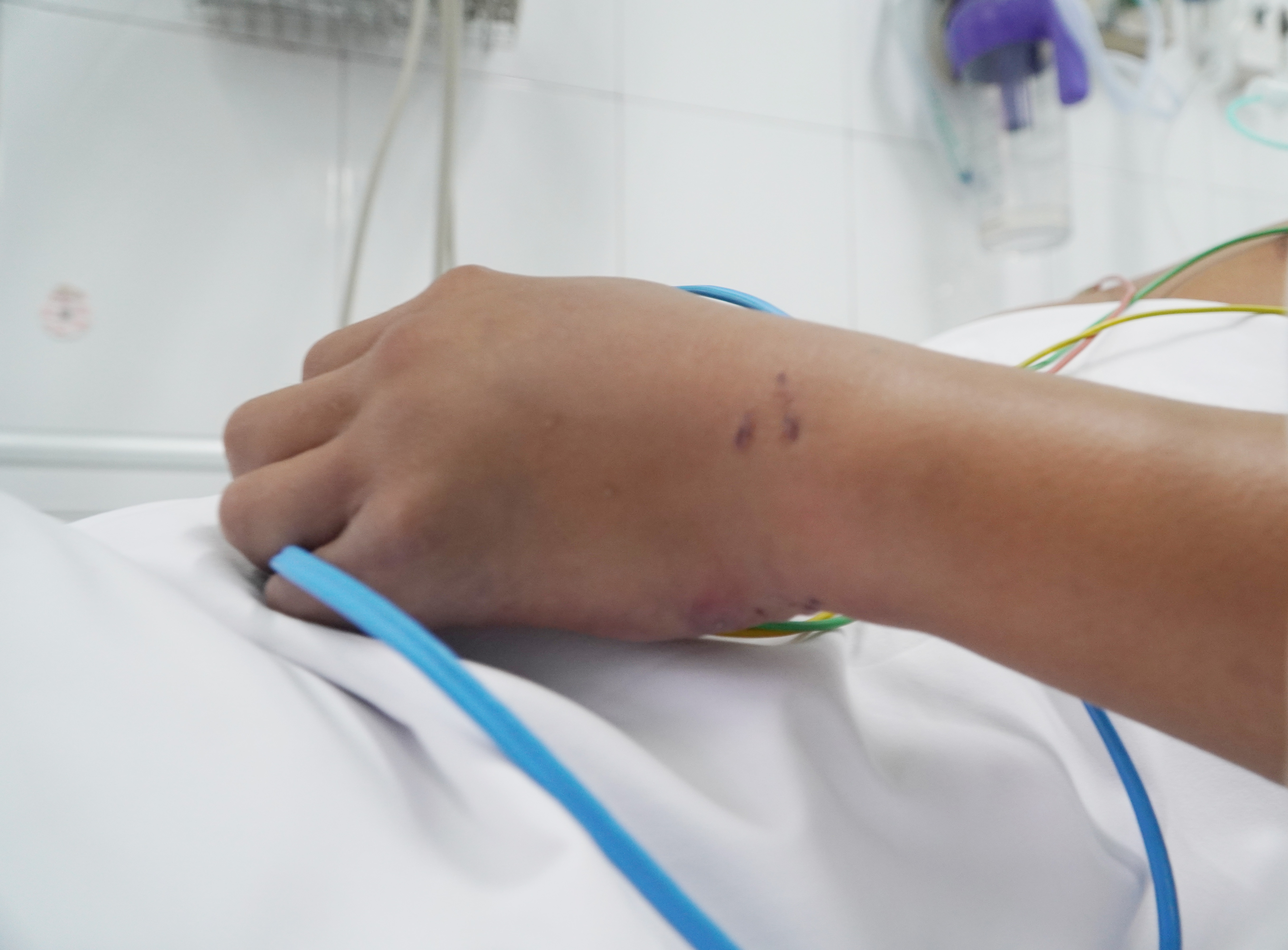 ran ho chua can anh 1