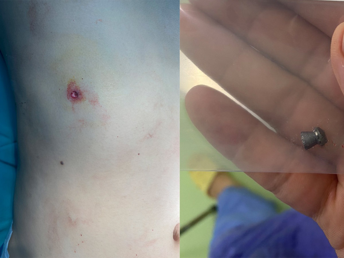 Cap cuu trong dem anh 1