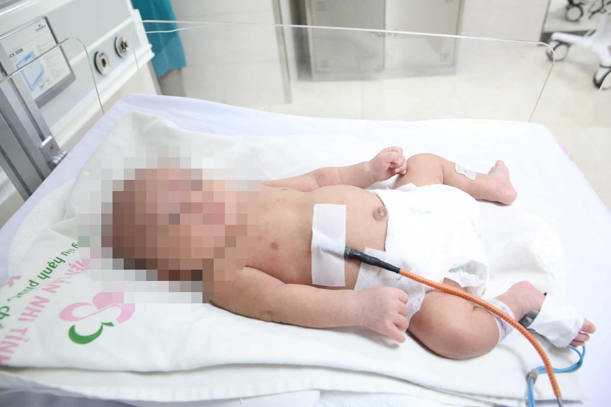 Nuoi song be sinh non nang 700 g hinh anh