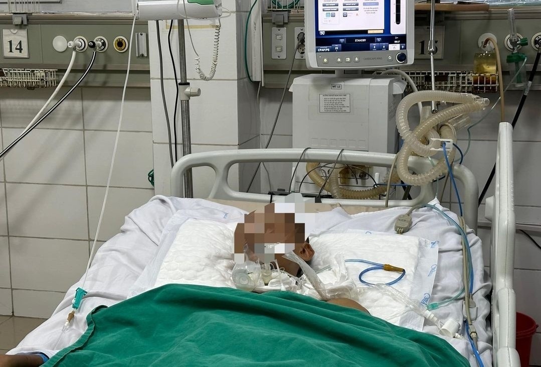 Hon me sau khi bi vien gach roi vao chan hinh anh