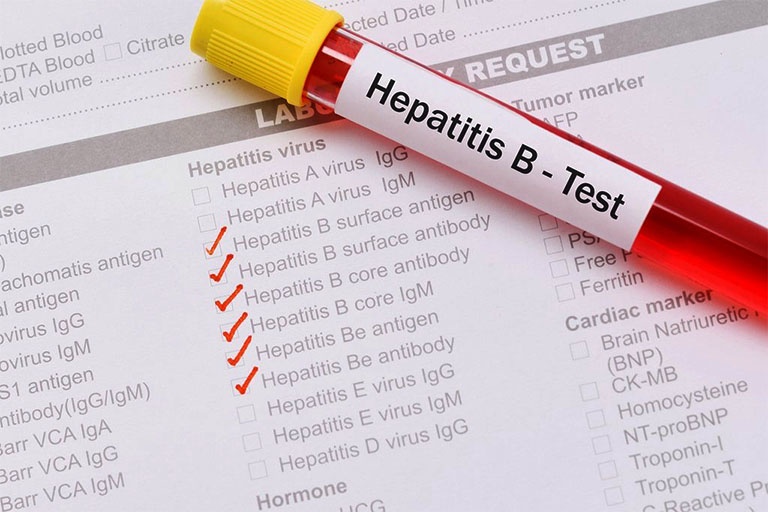 Toi co the sinh con khi mac viem gan B? hinh anh