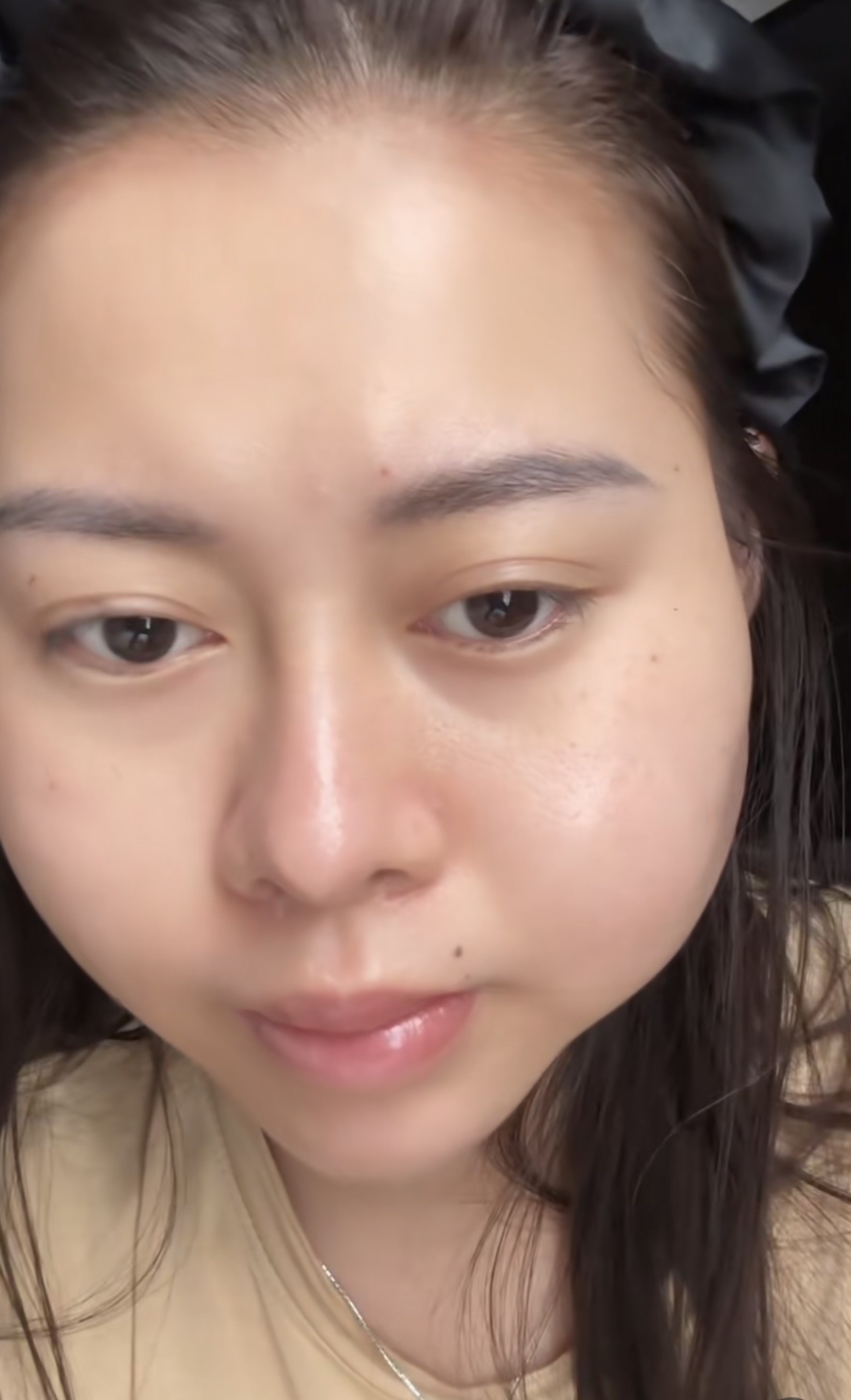 tiem silicone long anh 1