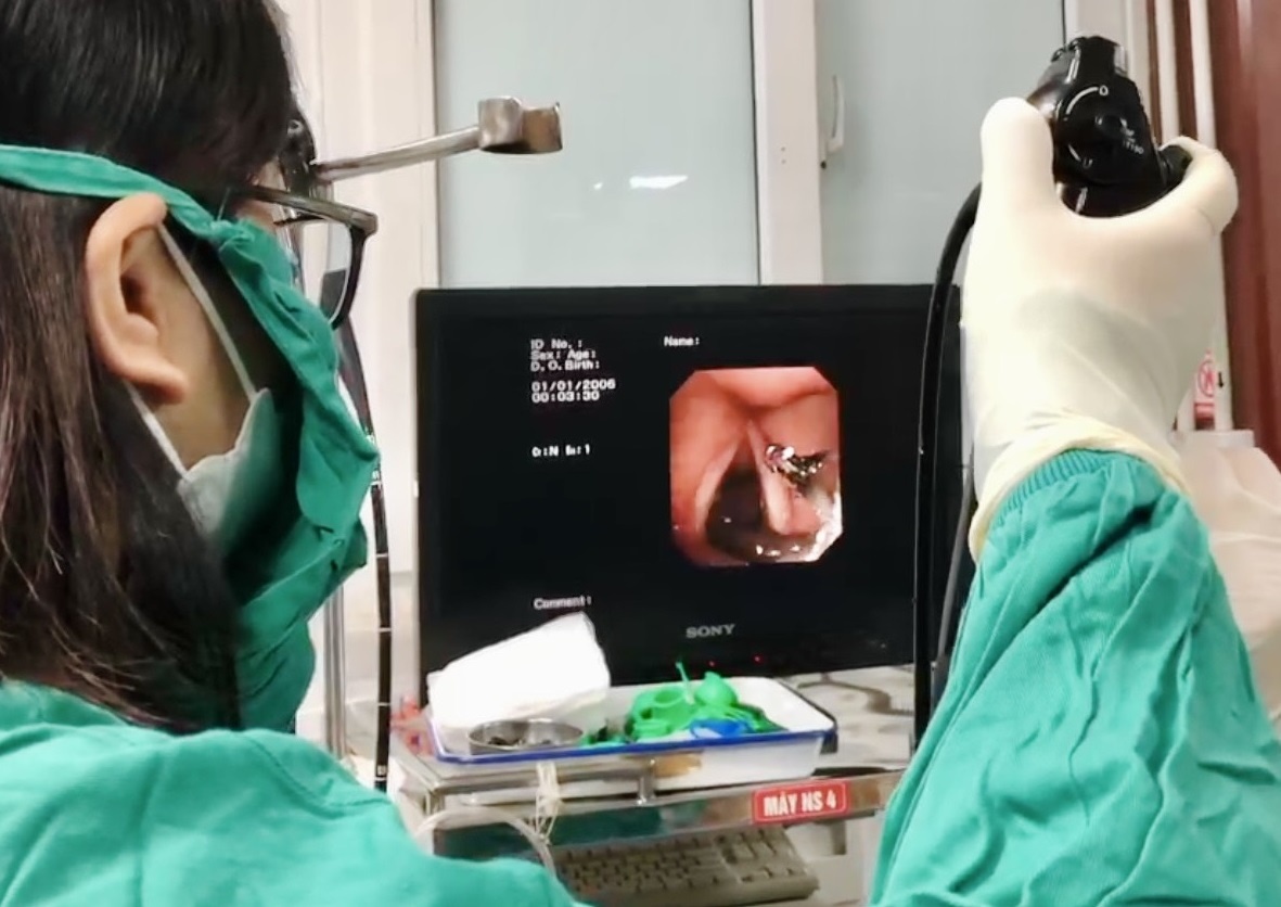 Ky sinh trung dai 5 cm song trong co hong thai phu hinh anh