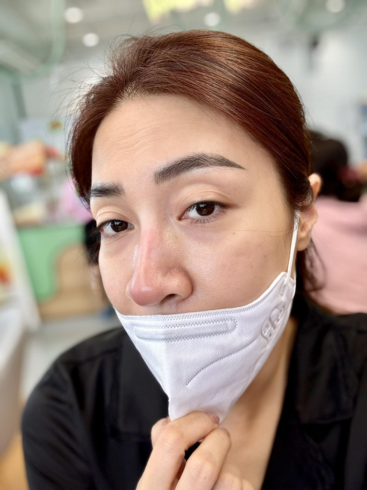 Pha Lê tháo sụn mũi ảnh 1 Pha Le thao sun mui anh 1