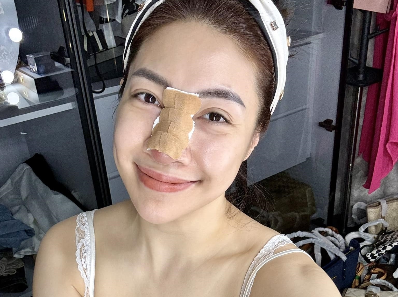 Ca si Pha Le bi bien chung sau nang mui hinh anh