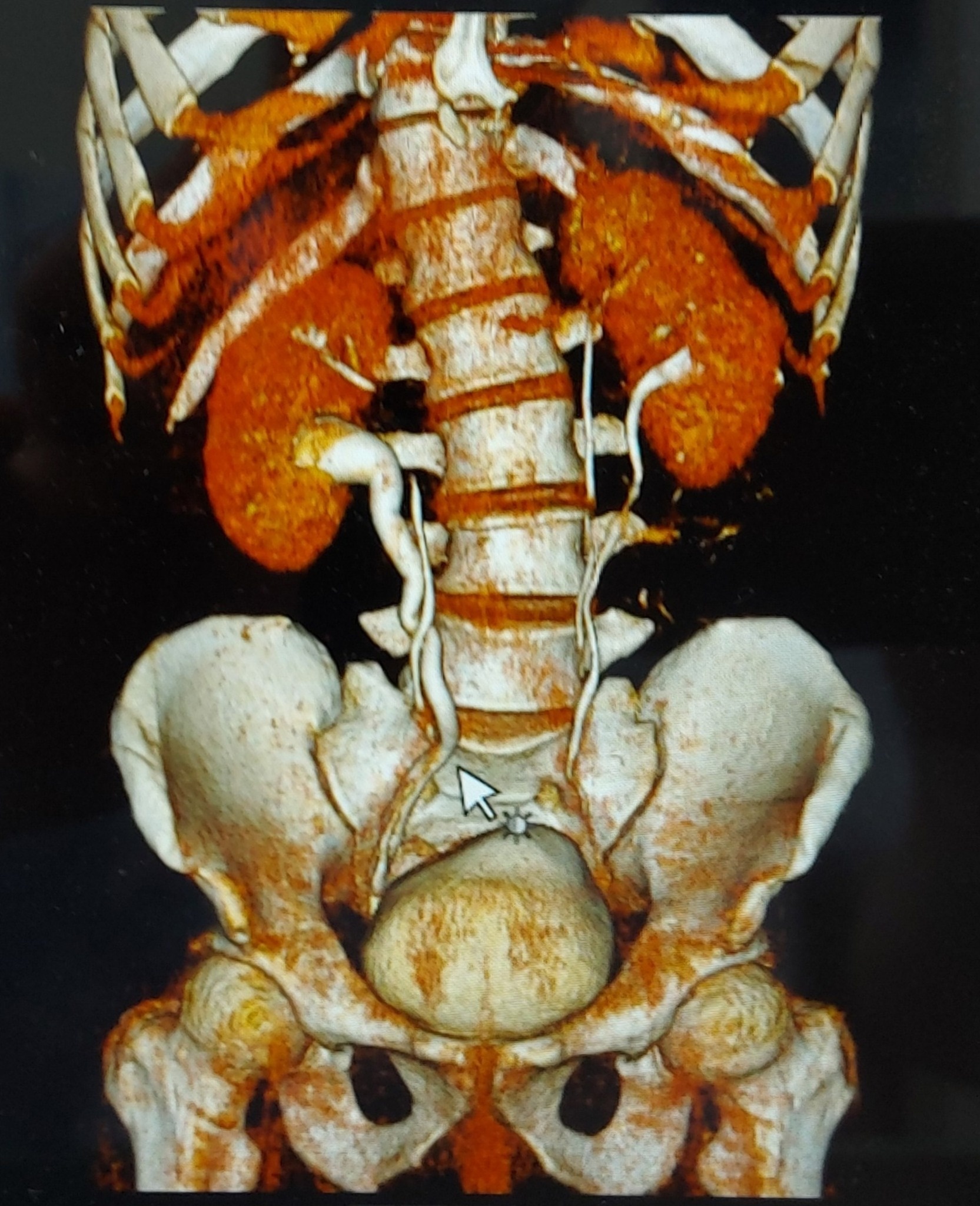 Nguoi co 4 qua than anh 1