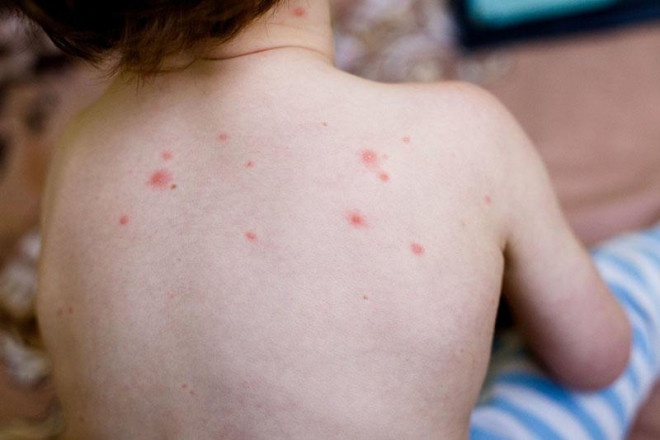 24 tre hoc cung mot lop mac thuy dau hinh anh