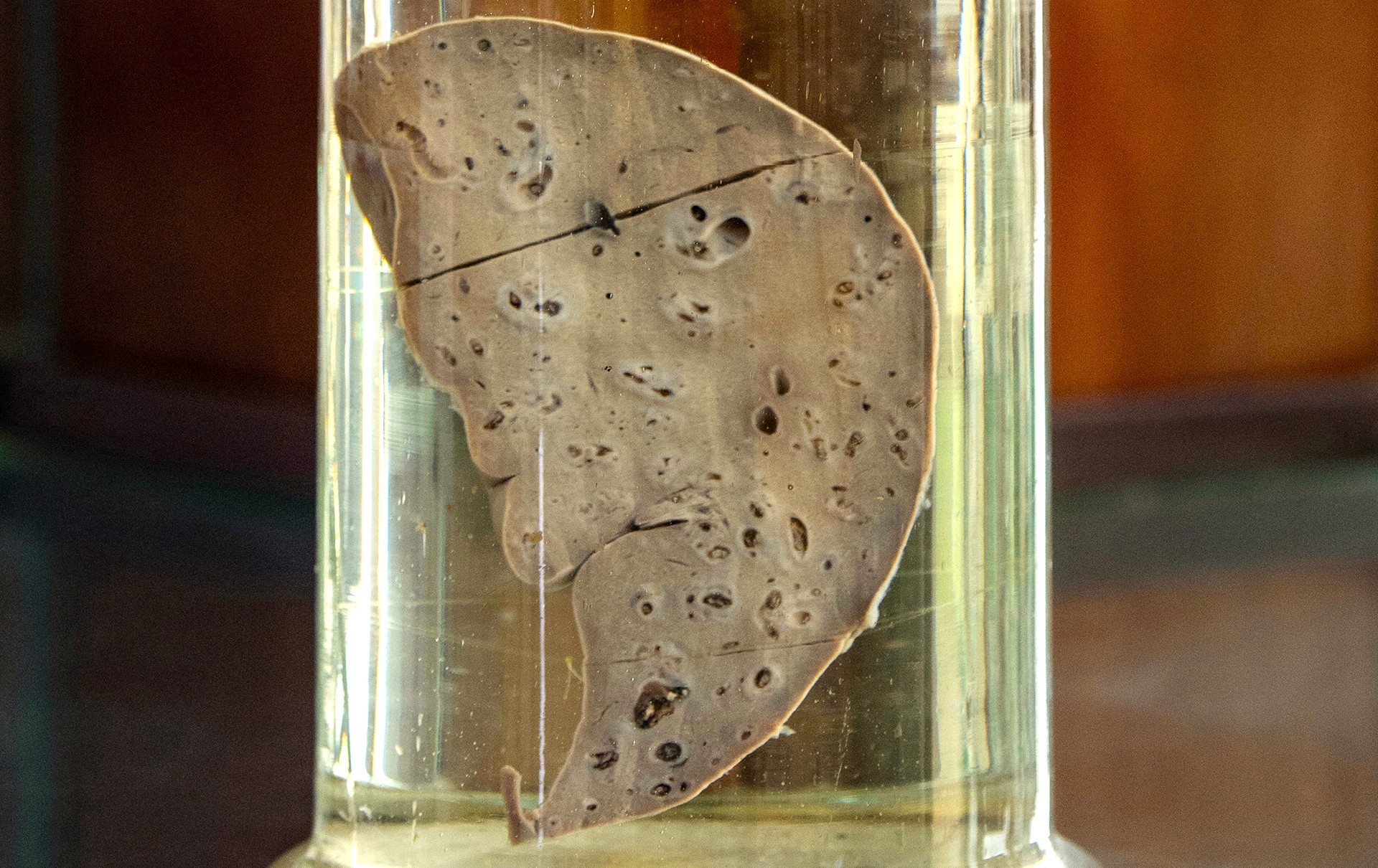 Mon 'khoai khau' nhieu nguy co nhung nguoi Viet ua chuong hinh anh