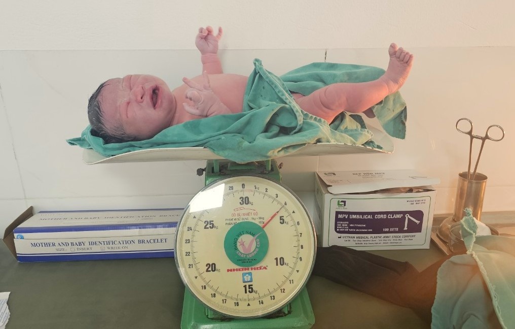 San phu de roi em be nang 4 kg o nha xe benh vien hinh anh