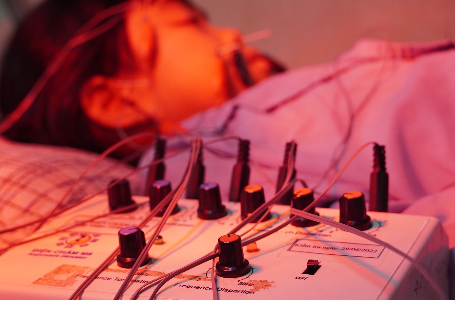 Can benh khien be gai 8 tuoi bat ngo meo mieng hinh anh