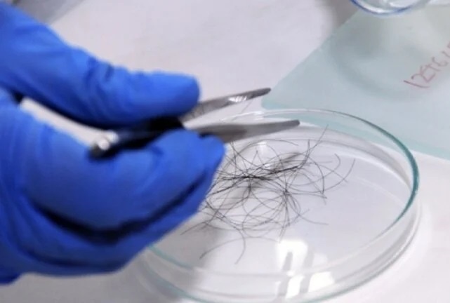 Xet nghiem ADN con, nguoi dan ong moi biet minh vo sinh, mang gene nu hinh anh