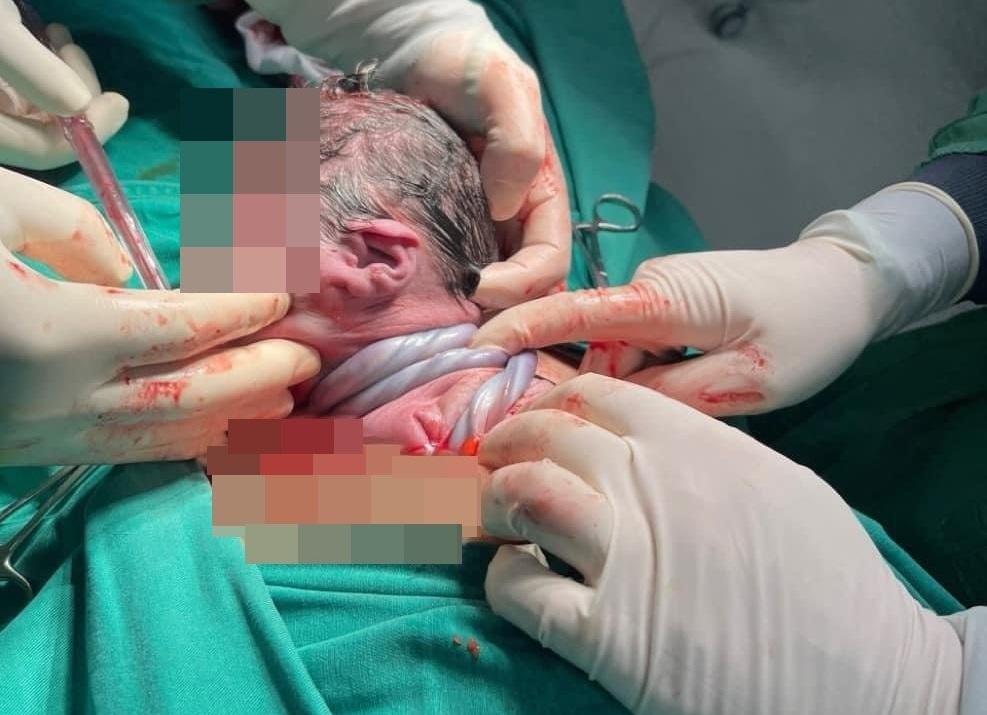 Em be chao doi voi day ron quan 3 vong co hinh anh