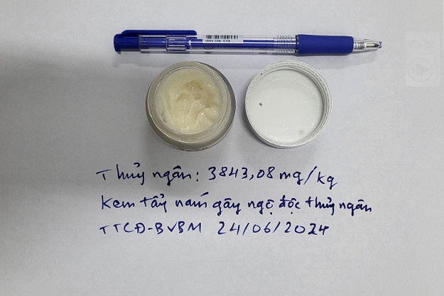 kem duong da thuy ngan anh 2