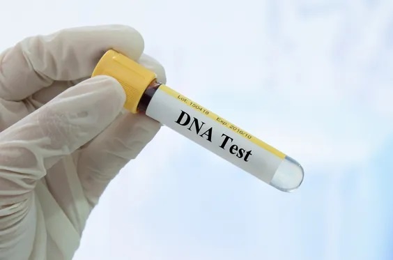 Chong xet nghiem ADN, phat hien su that ve con gai tu hanh dong la hinh anh