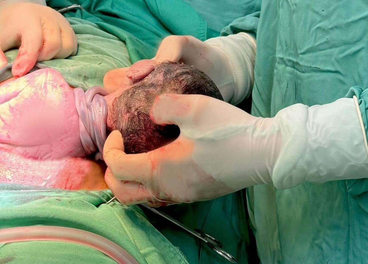 Cap song sinh 'sieu nghich' chao doi voi 3 vong day ron quan co hinh anh