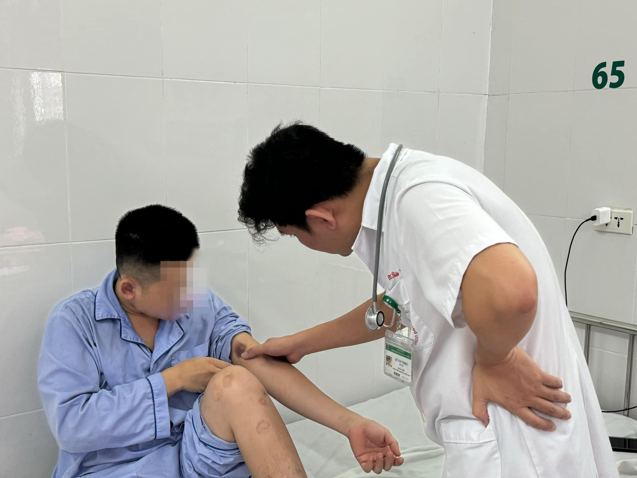 Giun san ky sinh khap co the nam thanh nien 21 tuoi hinh anh