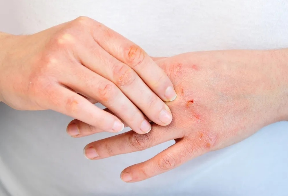 Dau hieu than dang dan mat chuc nang, nen di kham som hinh anh