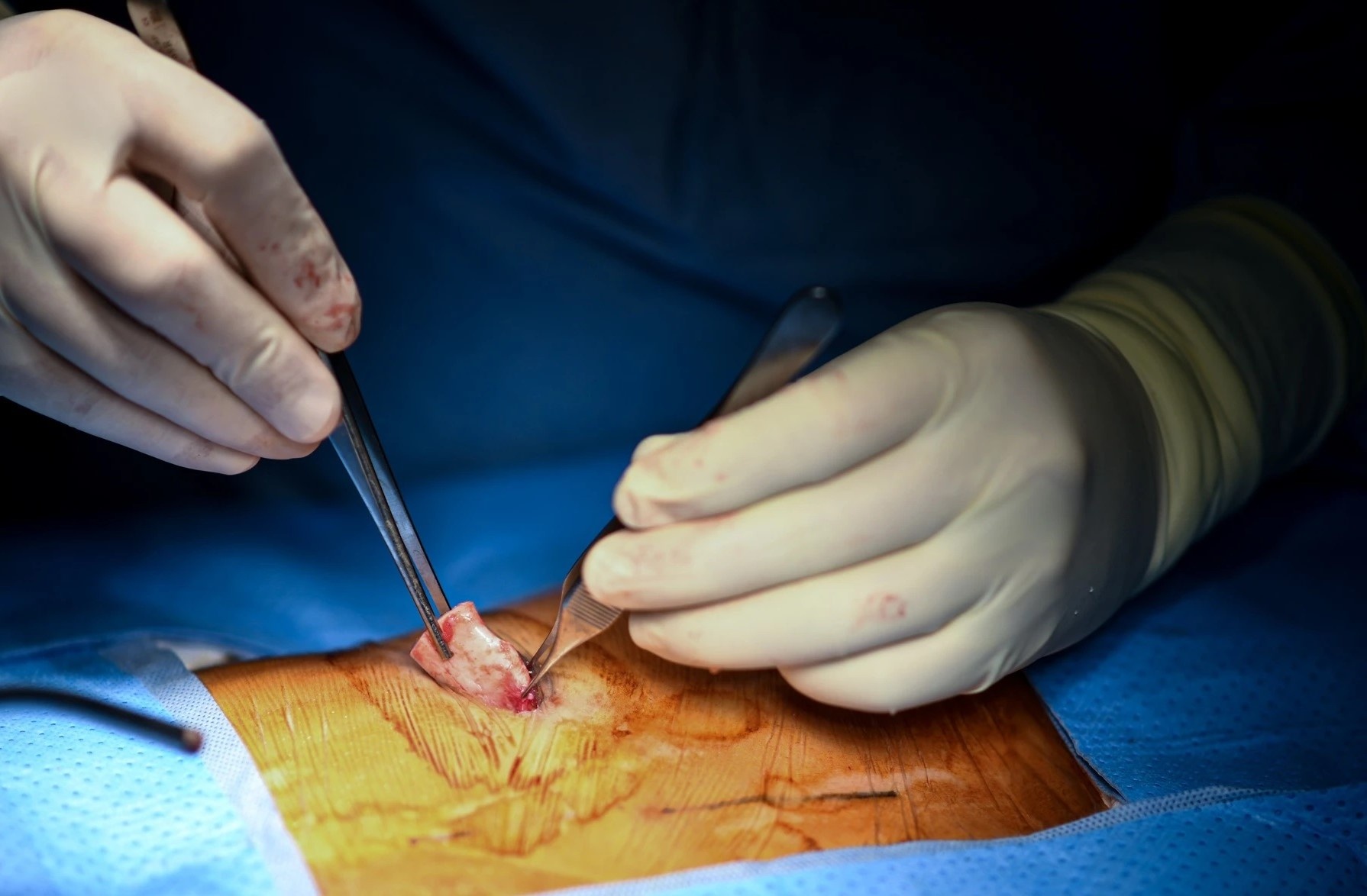 Nhieu co so tham my mao danh benh vien, Bo Y te vao cuoc hinh anh