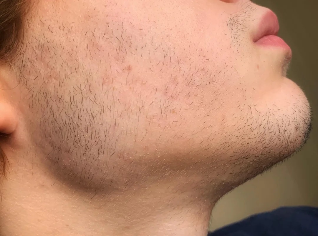 Dinh rau la gi? hinh anh