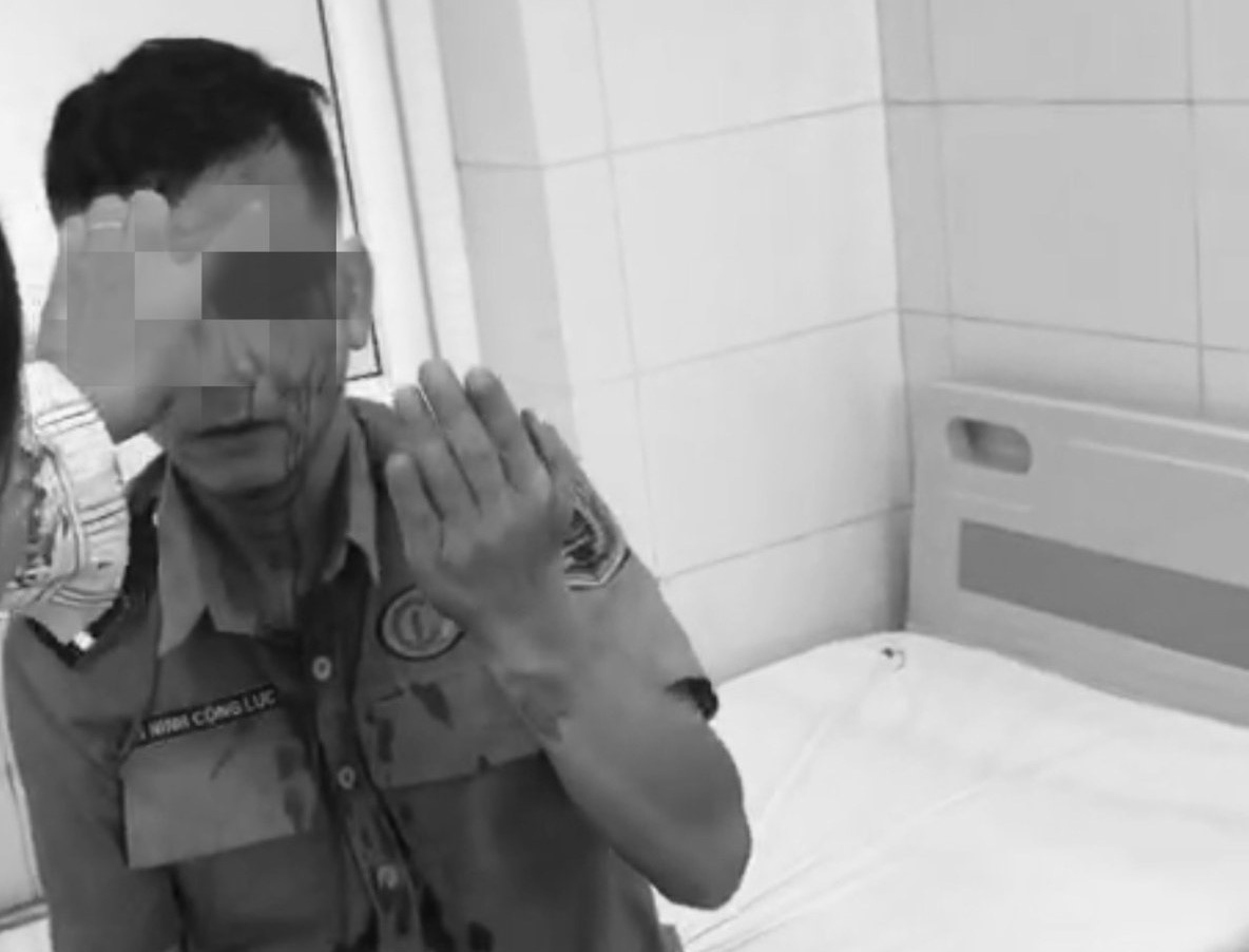 Bao ve bi hanh hung ngay tai cong Benh vien K hinh anh