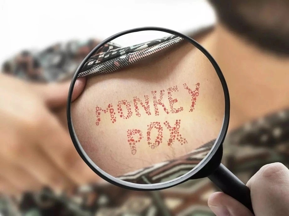 Dau hieu nghi ngo dang mac dau mua khi hinh anh