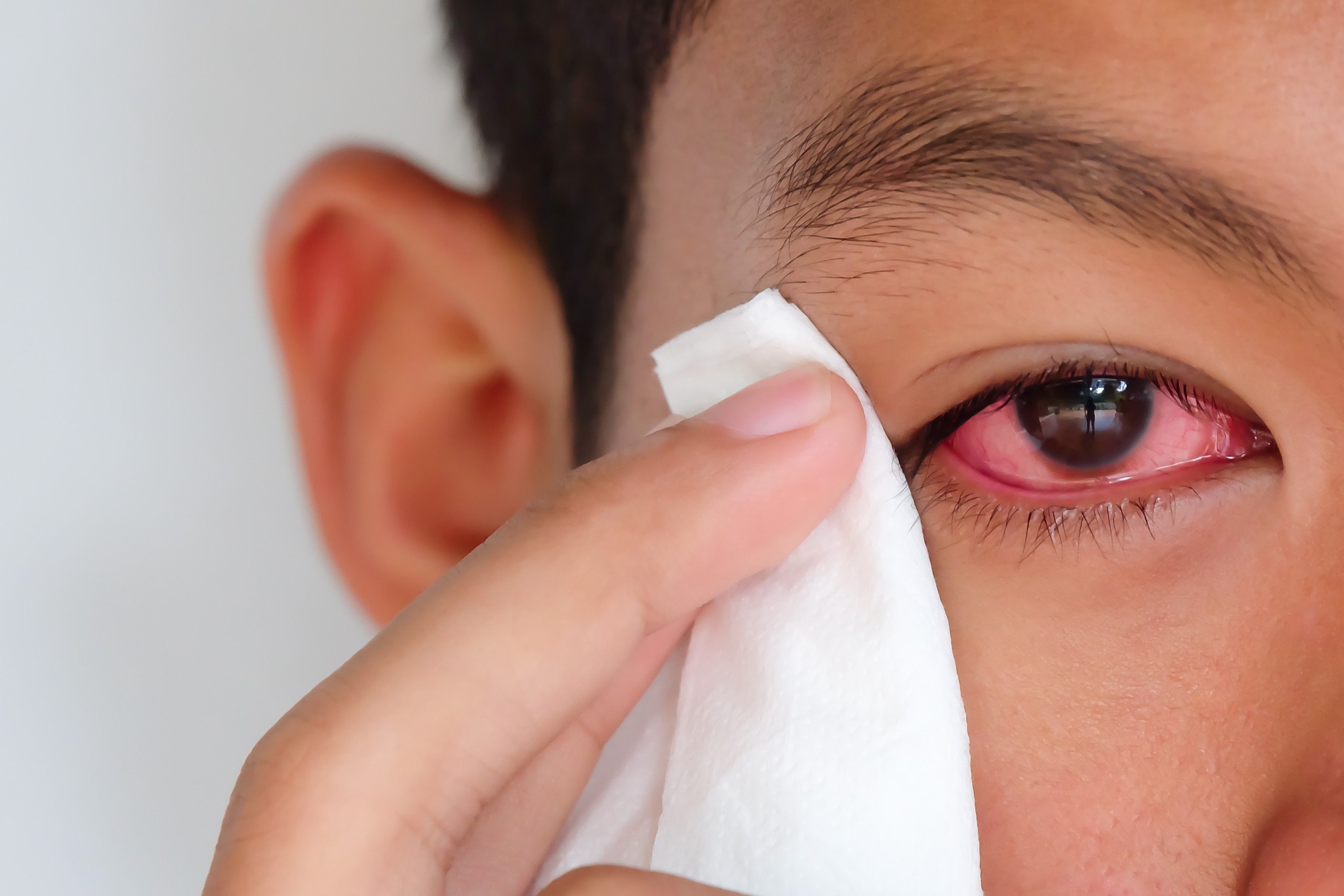 Nhin vao mat nguoi bi dau mat do co lay khong? hinh anh