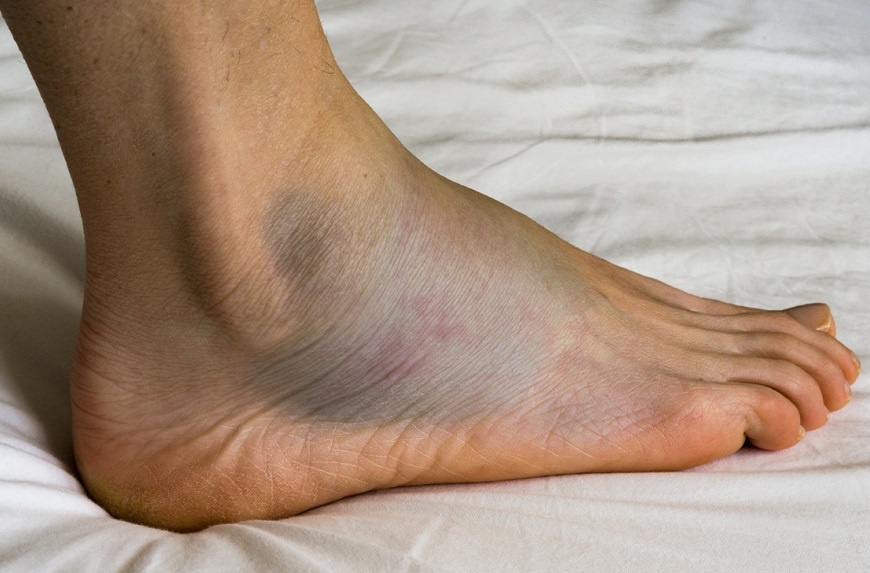 Nhung dau hieu canh bao suy tim de bi bo qua hinh anh