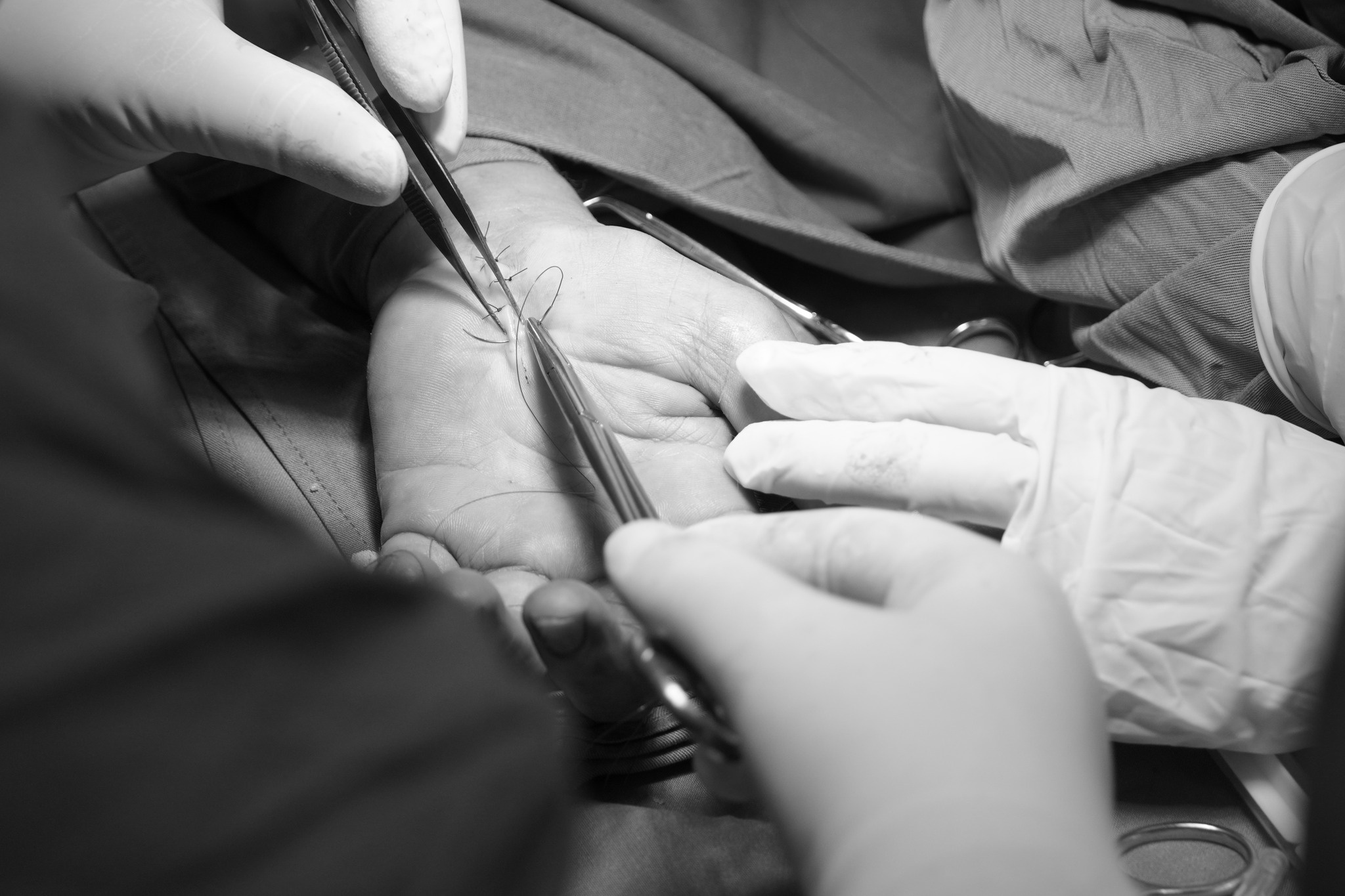 Can benh khien nguoi phu nu dau nhuc co tay suot 1 nam hinh anh