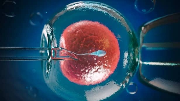 Tru dong trung ton bao nhieu tien? hinh anh