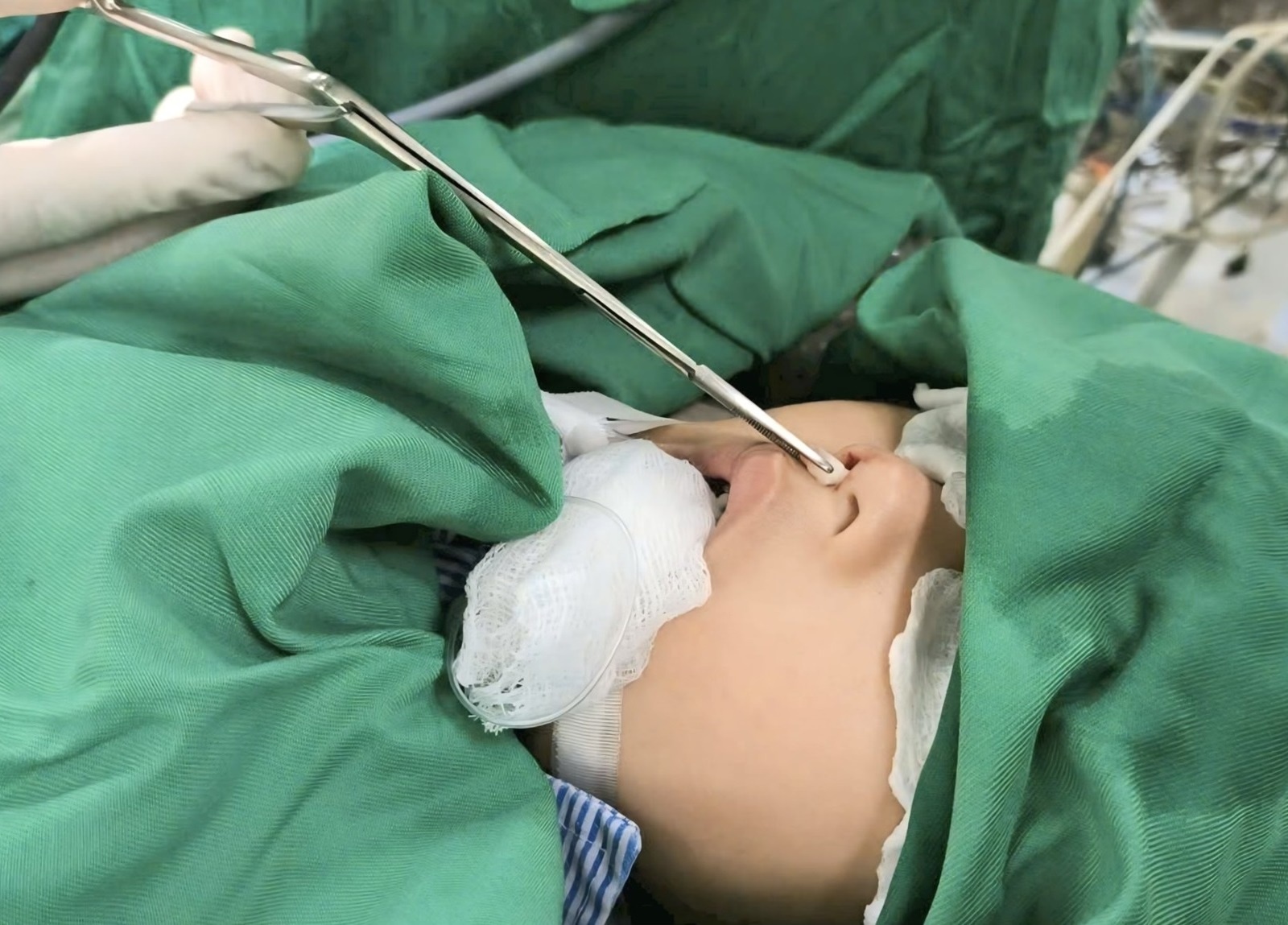 Rang moc o trong mui hiem gap hinh anh